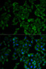 Immunofluorescence analysis of HeLa cells using TNFRSF1A Polyclonal Antibody