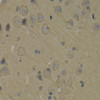 Immunohistochemistry of paraffin-embedded Rat brain using PI3 Kinase p85 alpha Polyclonal Antibody at dilution of  1:100 (40x lens).