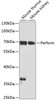 Western blot analysis of extracts of various cell lines using Perforin Polyclonal Antibody at dilution of 1:1000.