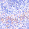 Immunohistochemistry of paraffin-embedded Mouse spleen using Perforin Polyclonal Antibody at dilution of  1:100 (40x lens).