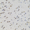 Immunohistochemistry of paraffin-embedded Rat brain using FoxO3a Polyclonal Antibody at dilution of  1:100 (40x lens).