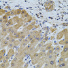 Immunohistochemistry of paraffin-embedded Human liver damage using FoxO3a Polyclonal Antibody at dilution of  1:100 (40x lens).