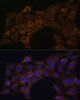 Immunofluorescence analysis of C6 cells using FoxO3a Polyclonal Antibody at dilution of  1:100. Blue: DAPI for nuclear staining.