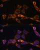 Immunofluorescence analysis of NIH/3T3 cells using FoxO3a Polyclonal Antibody at dilution of  1:100. Blue: DAPI for nuclear staining.