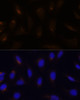 Immunofluorescence analysis of U-2 OS cells using FoxO3a Polyclonal Antibody at dilution of  1:100. Blue: DAPI for nuclear staining.