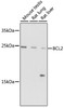 Western blot analysis of extracts of various cells using Bcl-2 Polyclonal Antibody at dilution of 1:1000.