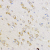 Immunohistochemistry of paraffin-embedded Rat brain using Bcl-2 Polyclonal Antibody at dilution of  1:100 (40x lens).