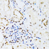 Immunohistochemistry of paraffin-embedded Human kidney using MAPK3 Polyclonal Antibody at dilution of  1:100 (40x lens).