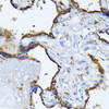 Immunohistochemistry of paraffin-embedded Human placenta using GRP78 / BiP Polyclonal Antibody at dilution of  1:100 (40x lens).