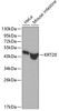 Western blot analysis of extracts of various cell lines using KRT20 Polyclonal Antibody.