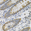 Immunohistochemistry of paraffin-embedded Human colon using KRT20 Polyclonal Antibody at dilution of  1:100 (40x lens).