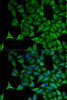 Immunofluorescence analysis of HeLa cells using KRT20 Polyclonal Antibody