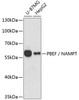 Western blot analysis of extracts of various cell lines using PBEF / NAMPT Polyclonal Antibody at dilution of 1:1000.