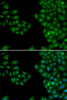 Immunofluorescence analysis of HeLa cells using NEFL Polyclonal Antibody