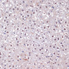 Immunohistochemistry of paraffin-embedded Rat liver using CDKN2A / p16INK4a Polyclonal Antibody at dilution of  1:100 (40x lens).