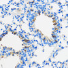 Immunohistochemistry of paraffin-embedded Mouse lung using PPAR gamma Polyclonal Antibody at dilution of  1:100 (40x lens).