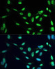 Immunofluorescence analysis of U2OS cells using PPAR gamma Polyclonal Antibody at dilution of  1:100. Blue: DAPI for nuclear staining.