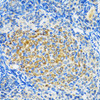 Immunohistochemistry of paraffin-embedded Rat ovary using SIRT2 Polyclonal Antibody at dilution of  1:100 (40x lens).