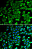 Immunofluorescence analysis of HeLa cells using SIRT2 Polyclonal Antibody