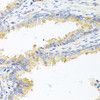 Immunohistochemistry of paraffin-embedded Human prostate using APOE Polyclonal Antibody at dilution of  1:100 (40x lens).