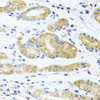 Immunohistochemistry of paraffin-embedded Human stomach using APOE Polyclonal Antibody at dilution of  1:100 (40x lens).