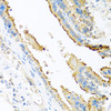 Immunohistochemistry of paraffin-embedded Mouse lung using APOE Polyclonal Antibody at dilution of  1:100 (40x lens).