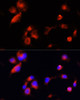 Immunofluorescence analysis of A431 cells using APOE Polyclonal Antibody at dilution of  1:100 (40x lens). Blue: DAPI for nuclear staining.