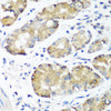 Immunohistochemistry of paraffin-embedded Human stomach using NOTCH2 Polyclonal Antibody at dilution of  1:100 (40x lens).