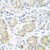 Immunohistochemistry of paraffin-embedded Human stomach using EIF3A Polyclonal Antibody at dilution of  1:100 (40x lens).