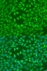 Immunofluorescence analysis of U2OS cells using EIF3A Polyclonal Antibody at dilution of  1:100. Blue: DAPI for nuclear staining.