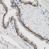 Immunohistochemistry of paraffin-embedded Human prostate using ATP1A Polyclonal Antibody at dilution of  1:100 (40x lens).