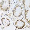 Immunohistochemistry of paraffin-embedded Human stomach using ATP1A Polyclonal Antibody at dilution of  1:100 (40x lens).