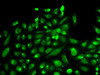 Immunofluorescence analysis of HeLa cells using SPHK1 Polyclonal Antibody