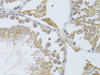 Immunohistochemistry of paraffin-embedded Rat testis using ATG13 Polyclonal Antibody at dilution of  1:100 (40x lens).