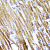 Immunohistochemistry of paraffin-embedded Rat heart using SOCS3 Polyclonal Antibody at dilution of  1:100 (40x lens).