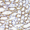 Immunohistochemistry of paraffin-embedded Mouse kidney using SOCS3 Polyclonal Antibody at dilution of  1:100 (40x lens).