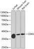 Western blot analysis of extracts of various cell lines using CDK6 Polyclonal Antibody at dilution of 1:1000.