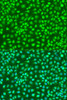 Immunofluorescence analysis of U2OS cells using IKK beta Polyclonal Antibody at dilution of  1:100. Blue: DAPI for nuclear staining.