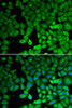 Immunofluorescence analysis of U2OS cells using NUR77 Polyclonal Antibody