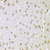 Immunohistochemistry of paraffin-embedded Rat brain using KU70 Polyclonal Antibody at dilution of  1:100 (40x lens).