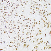 Immunohistochemistry of paraffin-embedded Human leiomyoma of uterus using KU70 Polyclonal Antibody at dilution of  1:100 (40x lens).