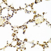 Immunohistochemistry of paraffin-embedded Mouse lung using KU70 Polyclonal Antibody at dilution of  1:100 (40x lens).