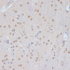 Immunohistochemistry of paraffin-embedded Mouse brain using CDK9 Polyclonal Antibody at dilution of  1:100 (40x lens).