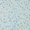 Immunohistochemistry of paraffin-embedded Rat liver using CEBPA Polyclonal Antibody at dilution of  1:100 (40x lens).