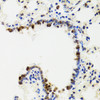 Immunohistochemistry of paraffin-embedded Rat lung using IKBKG Polyclonal Antibody at dilution of  1:100 (40x lens).