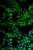 Immunofluorescence analysis of MCF-7 cells using IKBKG Polyclonal Antibody