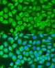 Immunofluorescence analysis of U2OS cells using MAP3K7 Polyclonal Antibody at dilution of  1:100. Blue: DAPI for nuclear staining.