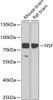 Western blot analysis of extracts of various cell lines using NSF Polyclonal Antibody at dilution of 1:1000.