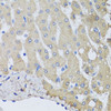 Immunohistochemistry of paraffin-embedded Human liver damage using NSF Polyclonal Antibody at dilution of  1:100 (40x lens).