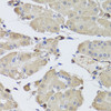 Immunohistochemistry of paraffin-embedded Human stomach using FABP5 Polyclonal Antibody at dilution of  1:100 (40x lens).